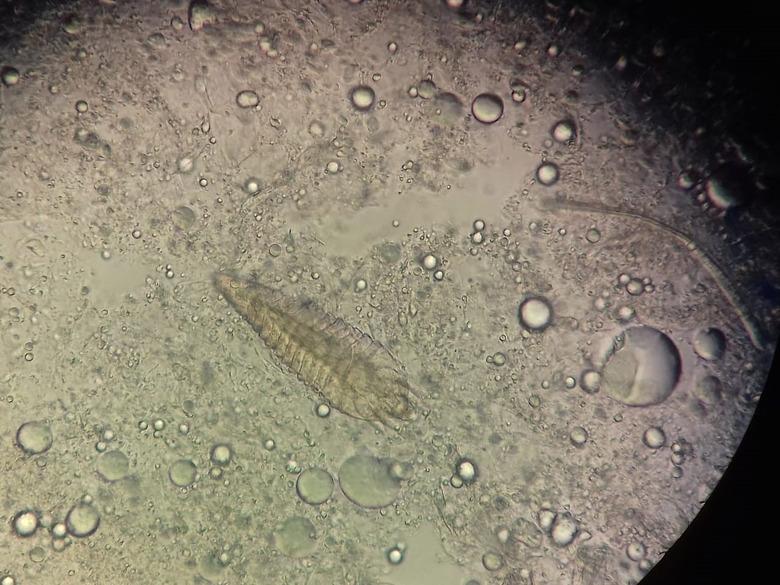 Demodex parasite under skin in dog or people take photo from microscope