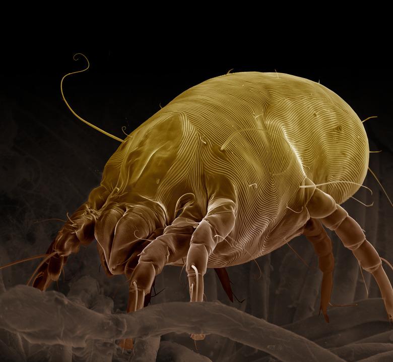 Dust Mite, Dermatophagoides pteronyssinus