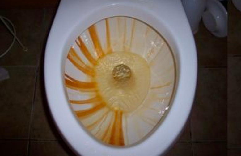 Stained toilet bowl.