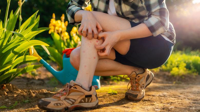 Woman with bug bites on her legs, scratching her legs in the garden.